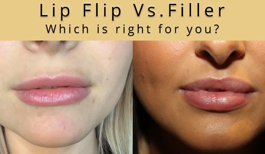 Lip Fillers vs. Dermal Fillers: What Is the Difference?